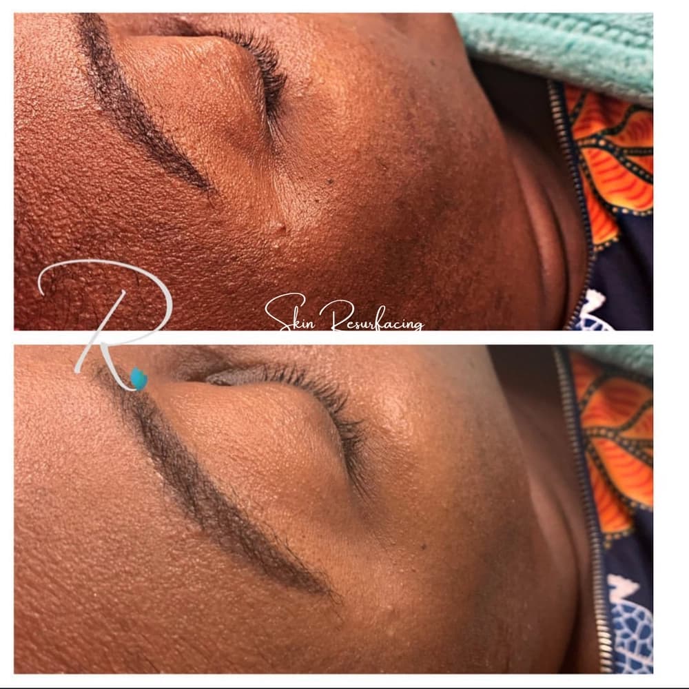 Relaxation facial treatment in Hamilton at Radiance Laser & Medical Aesthetics