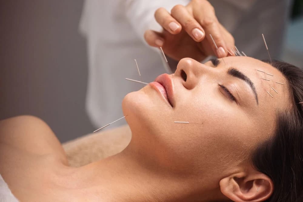 Cosmetic acupuncture facial rejuvenation at Radiance Laser & Medical Aesthetics