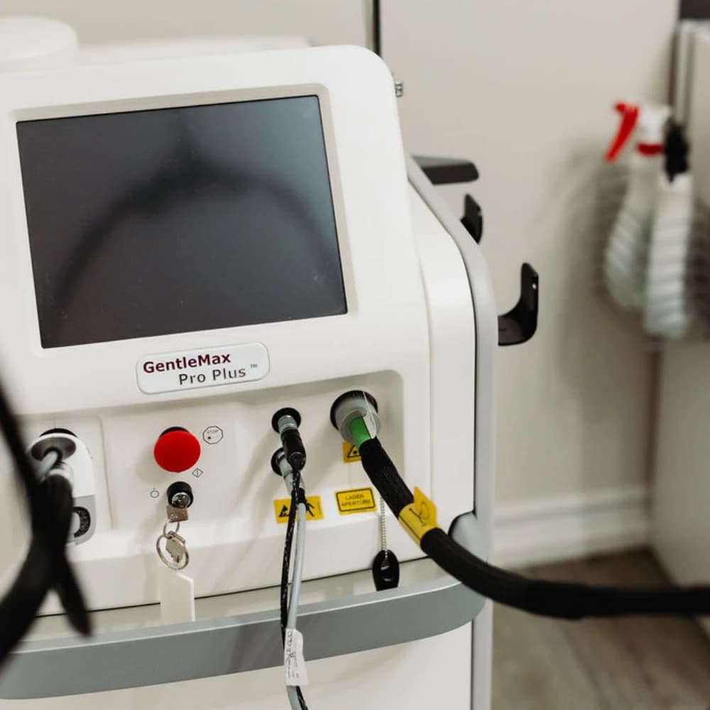 Candela GentleYag Pro-U laser technology at Radiance Laser & Medical Aesthetics