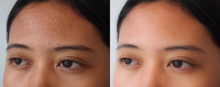 brow-tint-before-after
