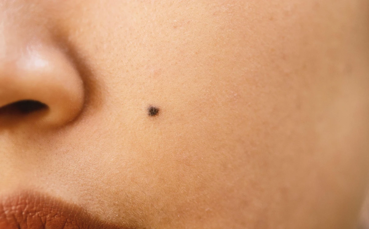 Mole removal service in Hamilton