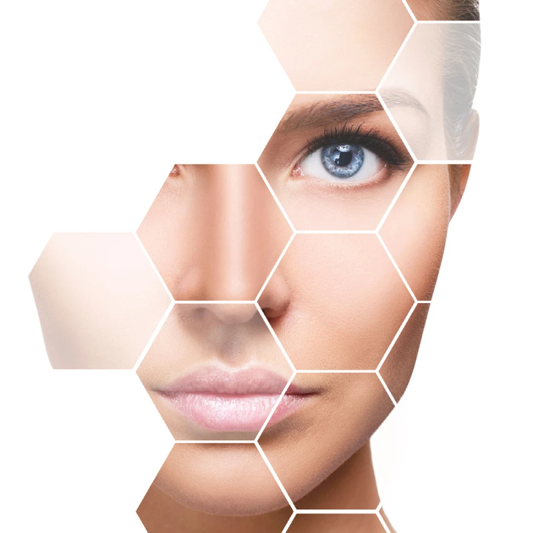 Skin resurfacing service in Hamilton